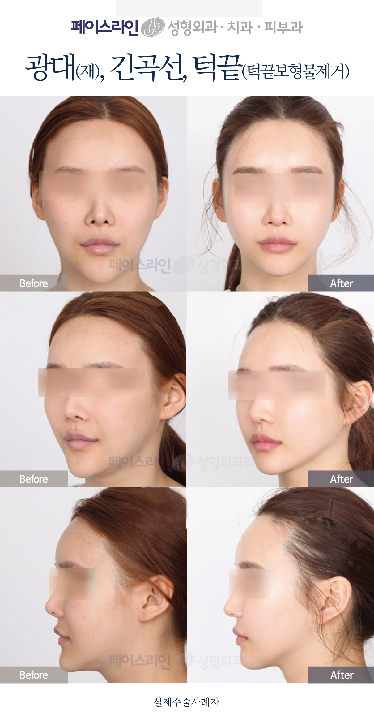 [object Object]