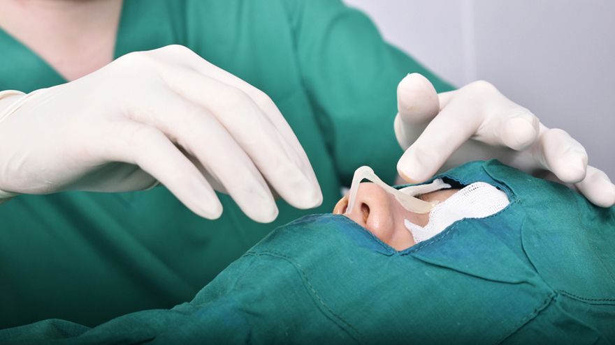 The Silicone Nose Implant Procedure
