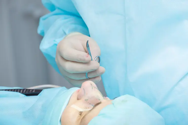 Rhinoplasty Procedure