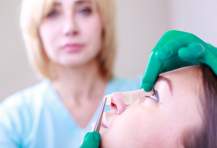 Recovery after rhinoplasty