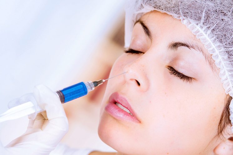 Non-Implant Rhinoplasty