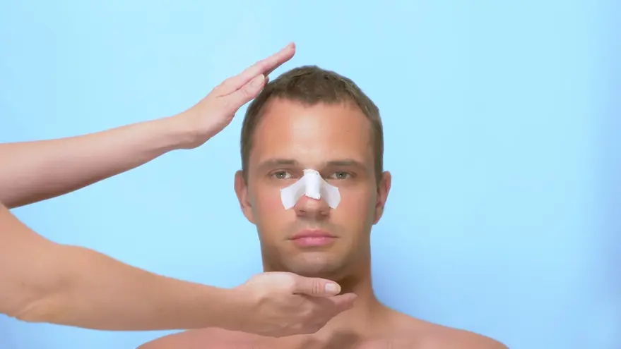 Male Revision Rhinoplasty