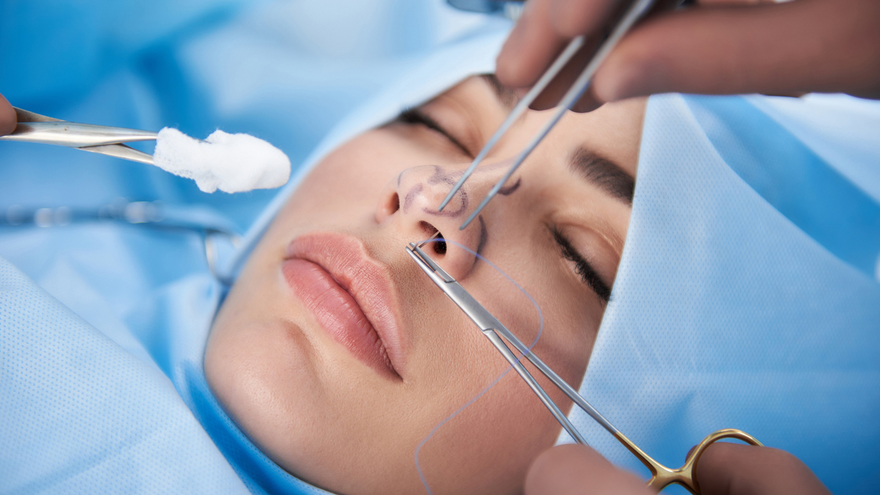 Introduction: Understanding Non-Implant Rhinoplasty
