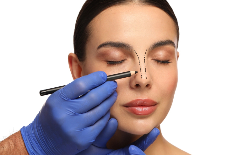 Needing a Revision Rhinoplasty
