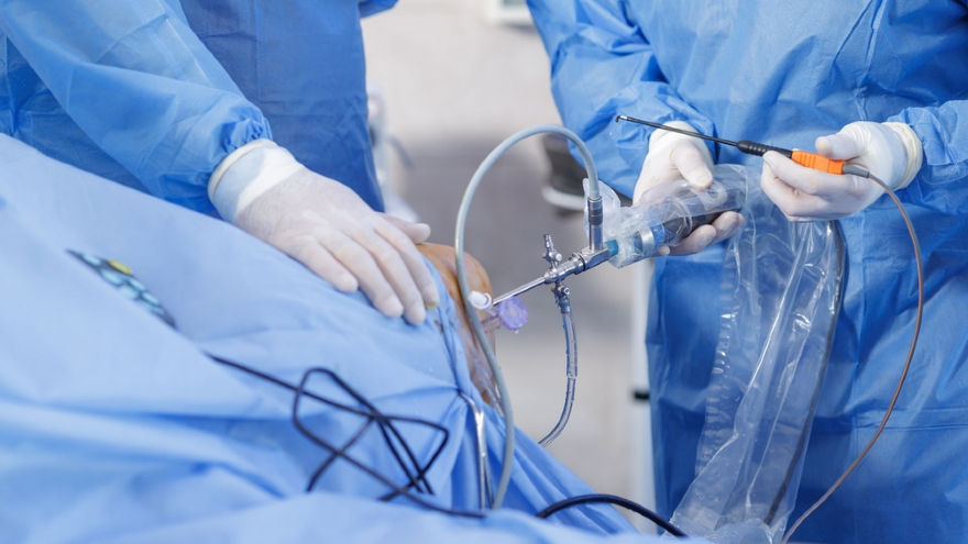 If You're Considering Cartilage Grafting