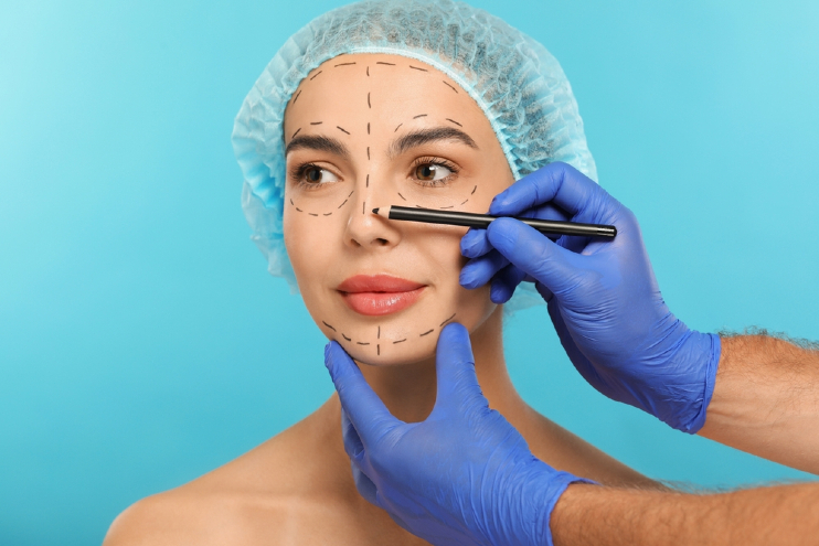 Tip-Only Rhinoplasty