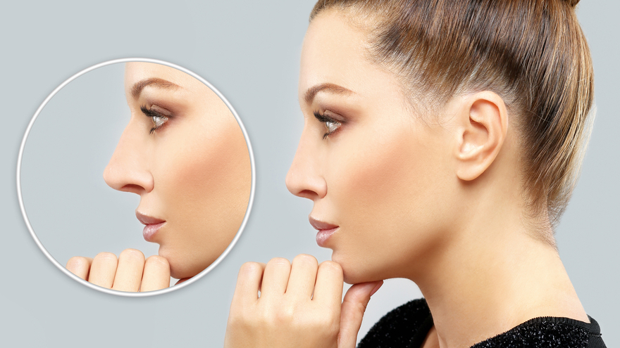Nose Job Can Change the Way People