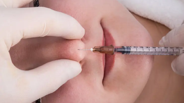Tip Rhinoplasty Treatment Process