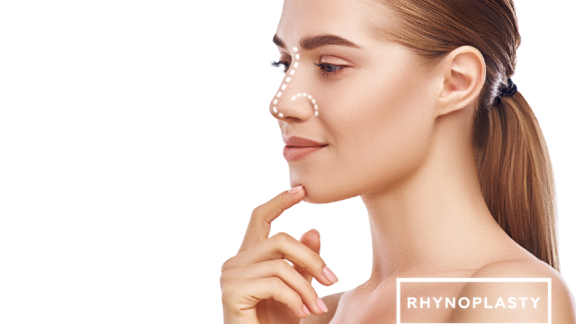 Rhinoplasty