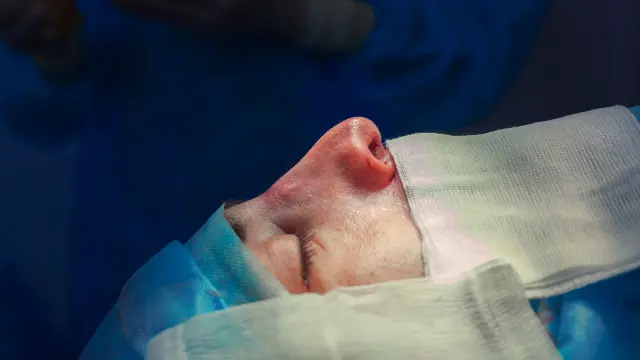 Nose Job Korea