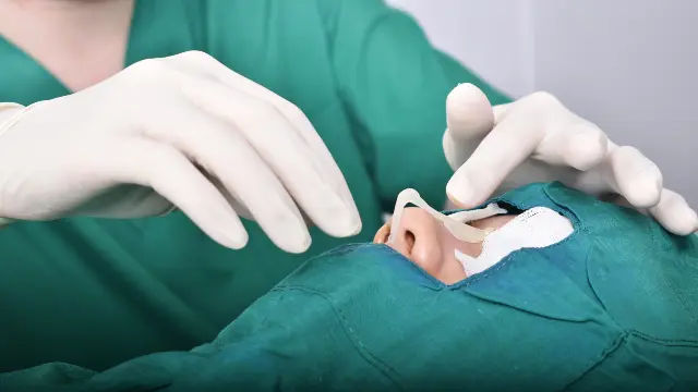 revision rhinoplasty surgery