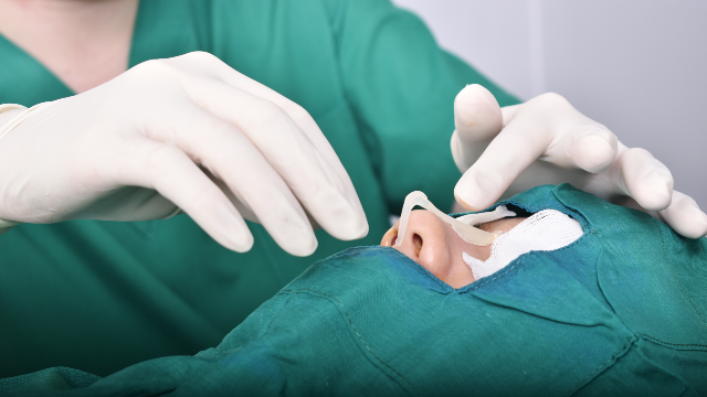 Revision Rhinoplasty Procedure