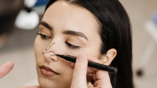 Major Revision Rhinoplasty in Revision Rhinoplasty