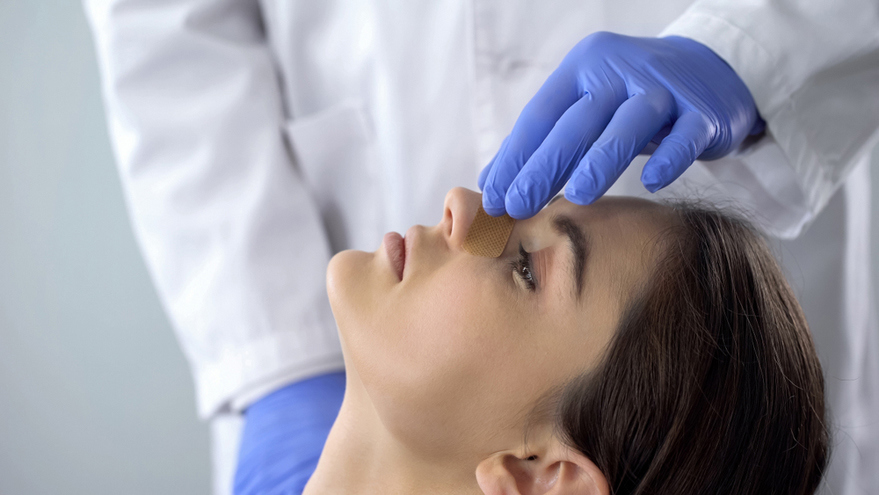 Recovery after Rhinoplasty
