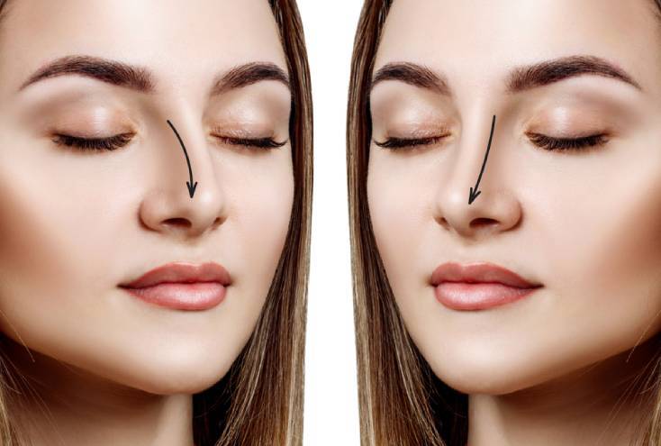 Why Choose Kowon Plastic Surgery?