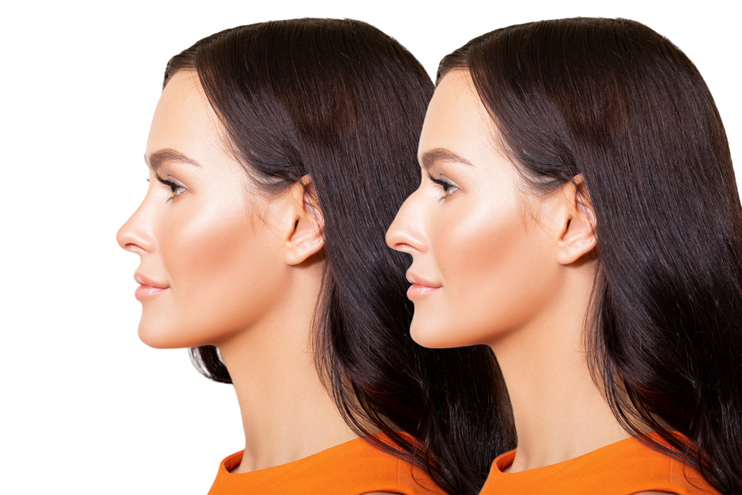 before and after photos