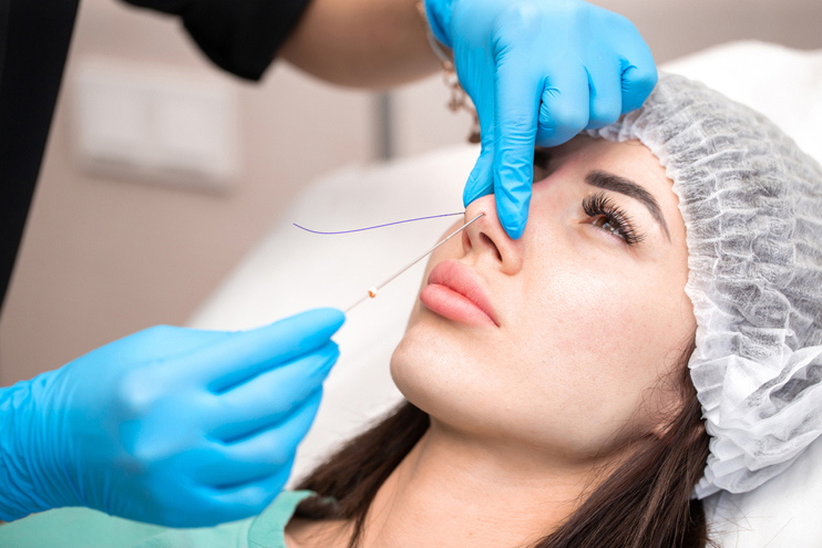 Rhinoplasty
