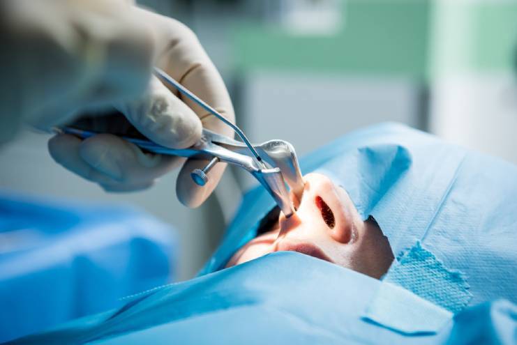 Procedure Techniques at a Glance