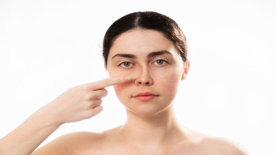 Nose Bridge Without Surgery
