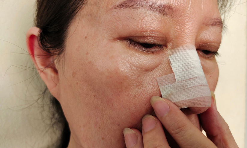 Infection and Post-Operative Complications