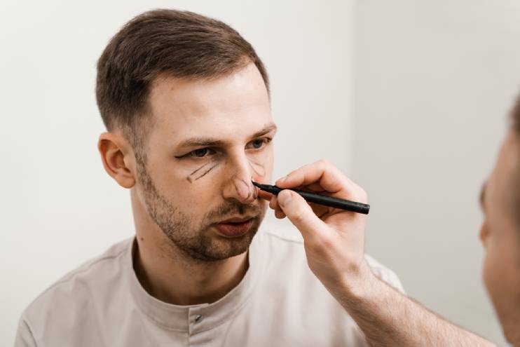 The Rising Popularity of Rhinoplasty for Men