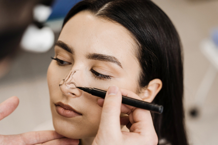 Global Popularity and Trends in Rhinoplasty Candidacy