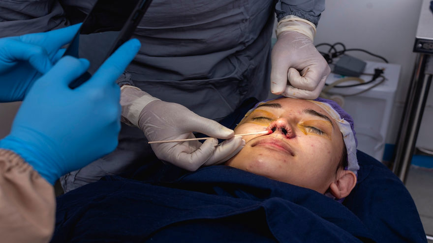 Pinched Nostril Correction