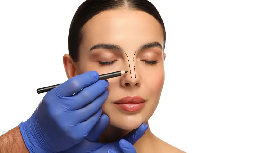 Revision Rhinoplasty: When & Why to Consider a Second Surgery