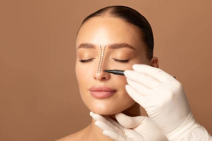 Non-Implant Rhinoplasty