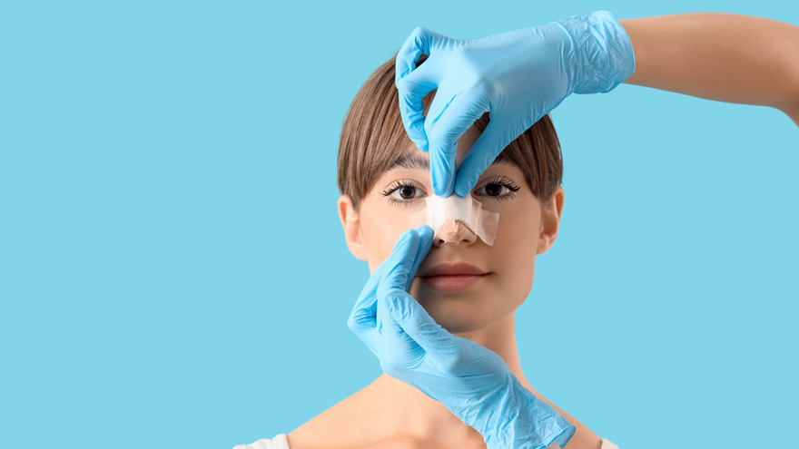Rhinoplasty