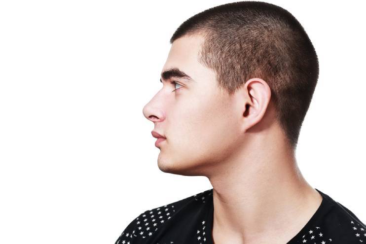 Benefits of Rhinoplasty for Protruding Nose in Men