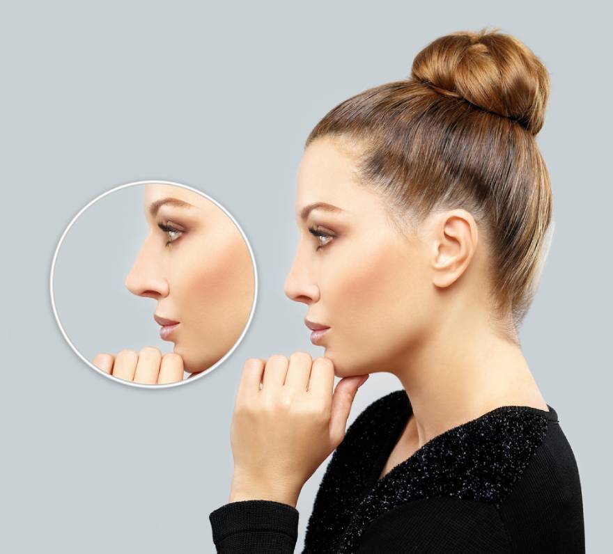 Recovery After Rhinoplasty Surgery