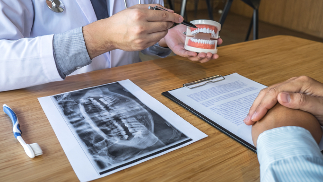 Locator Attachment Dentures: A Guide to Implant-Retained Removable Prosthetics