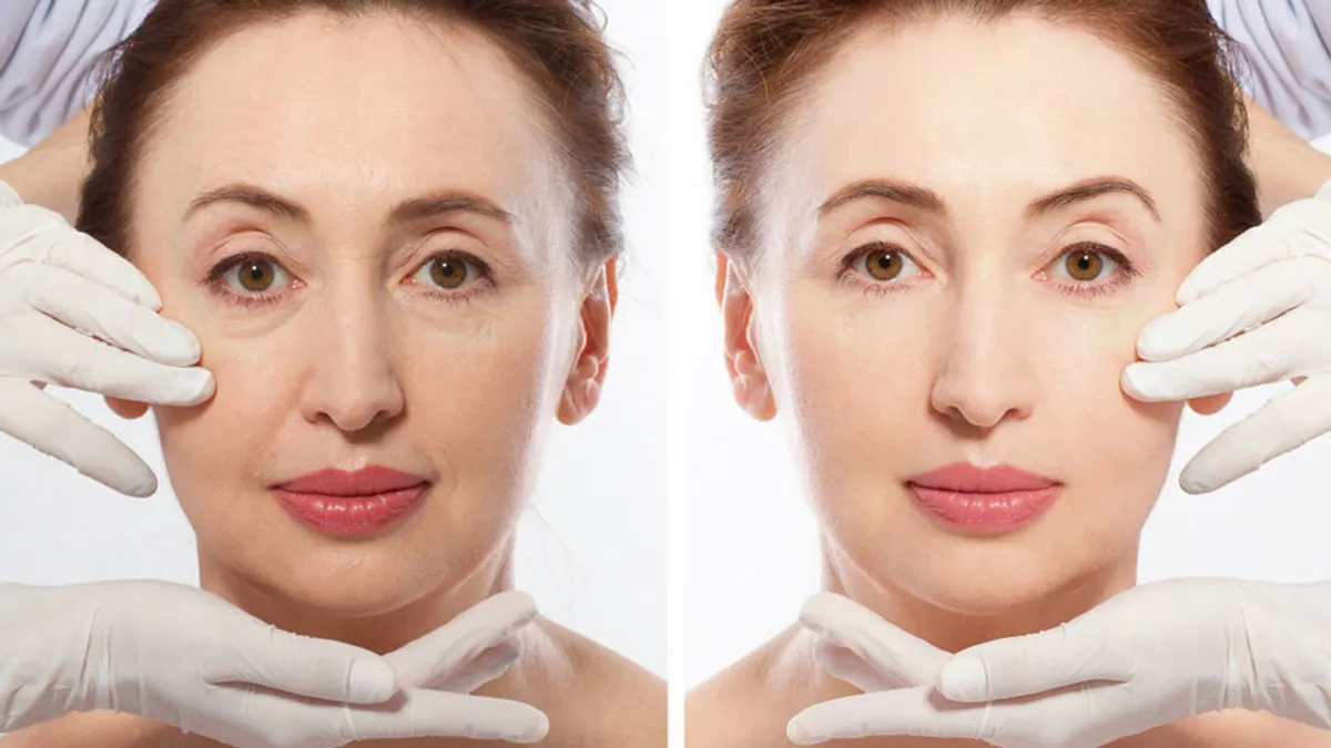 Mini Contouring Treatments That Show in Time for Your Photoshoot