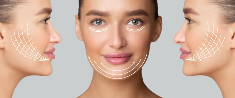 Facial Vector Mapping: How an Injectable Plan Is Made