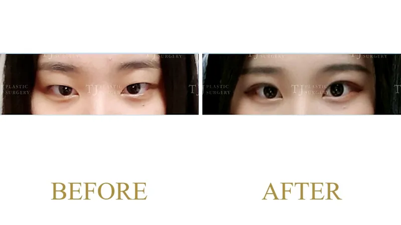 Plastic Surgery Case 1 — Case 1