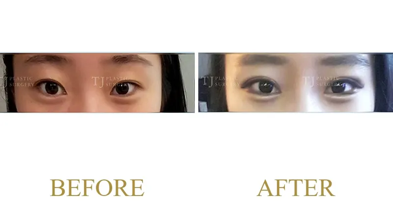 Plastic Surgery Case 3 — Case 3