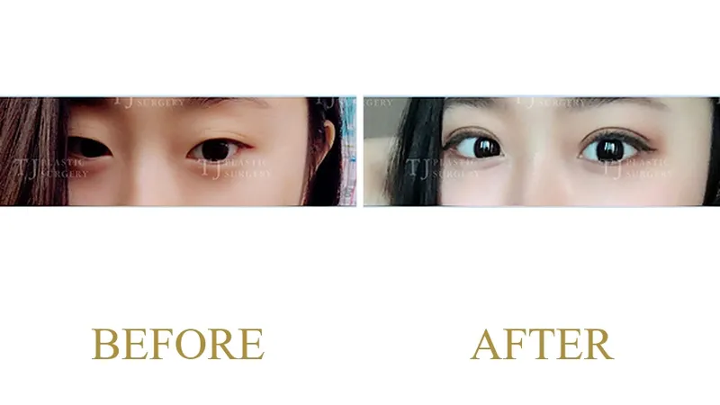 Plastic Surgery Case 4 — Case 4