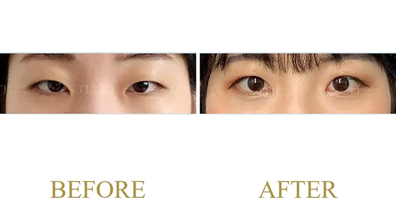 Plastic Surgery Case 9 — Case 9