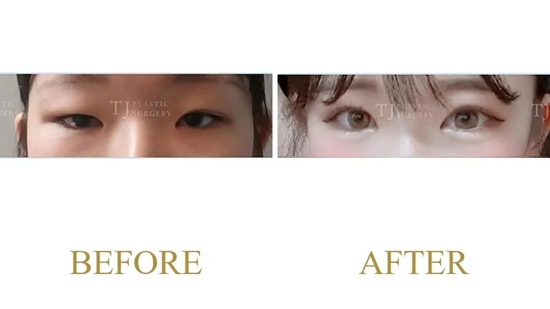 Plastic Surgery Case 8 — Case 8
