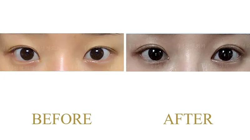 Plastic Surgery Case 12 — Case 12