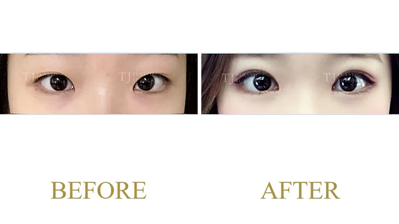 Plastic Surgery Case 10 — Case 10