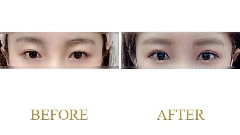 Plastic Surgery Case 7 — Case 7