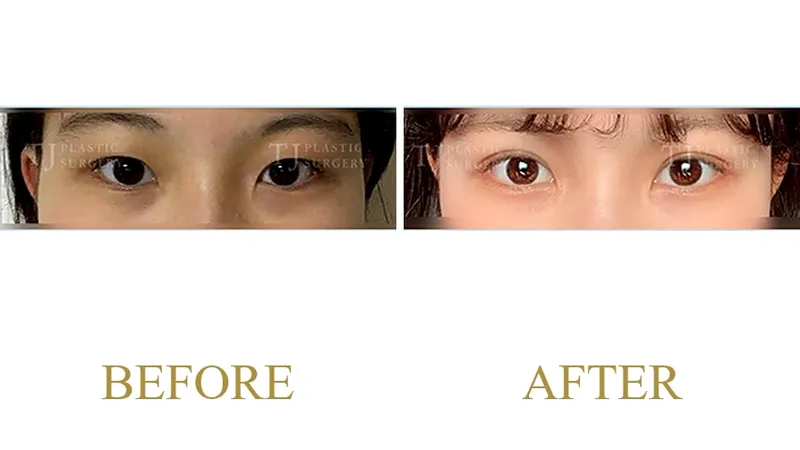 Plastic Surgery Case 6 — Case 6