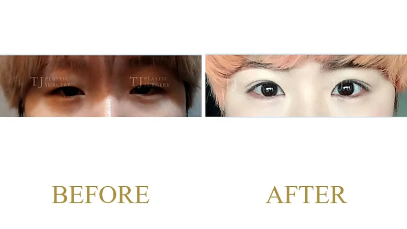 Plastic Surgery Case 5 — Case 5