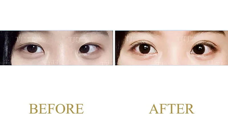 Plastic Surgery Case 2 — Case 2