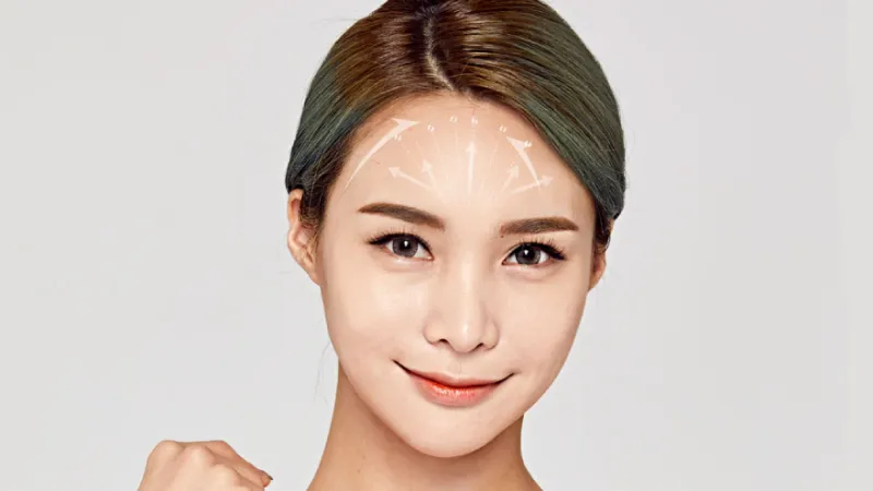 Forehead Augmentation