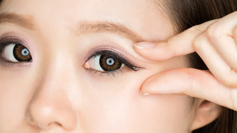 Double Eyelid Recovery: Stages, Not a Single Date