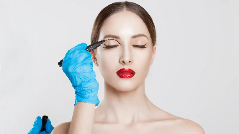 Partial Incision Double Eyelid Surgery: Procedure and Candidacy
