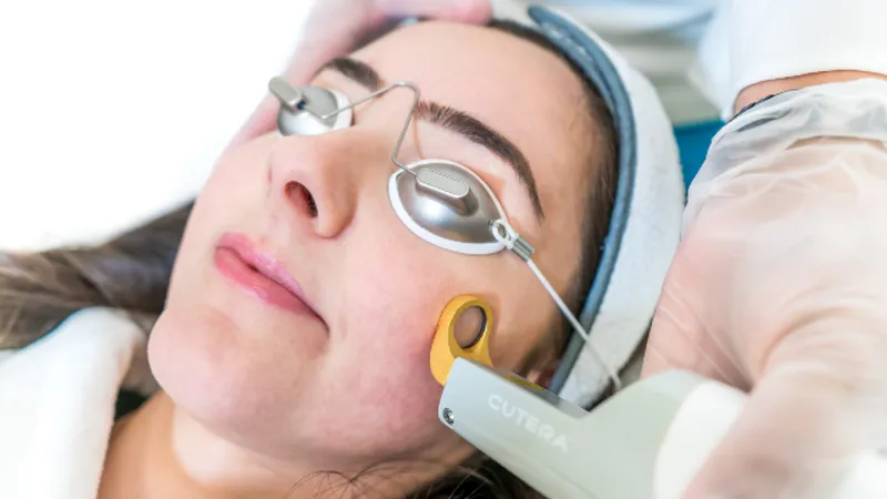 HALO Laser Korea: Two Wavelengths in One Treatment Pass